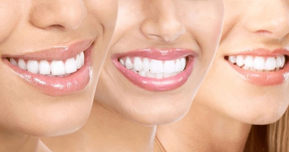 restoring teeth your smile